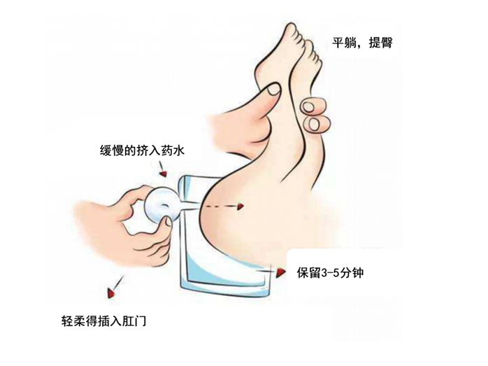 最新清洁灌肠教程视频观点全面解析